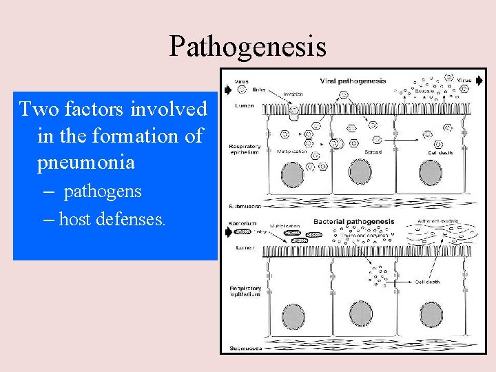 Pathogenesis Two factors involved in the formation of pneumonia – pathogens – host defenses.