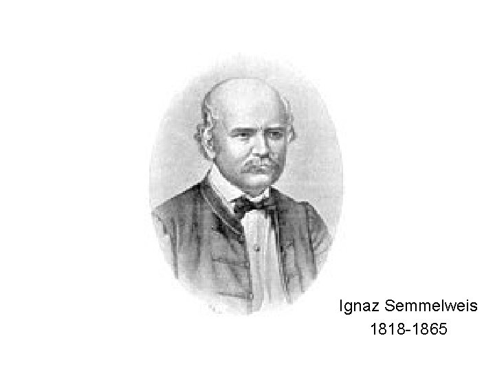 Ignaz Semmelweis 1818 -1865 