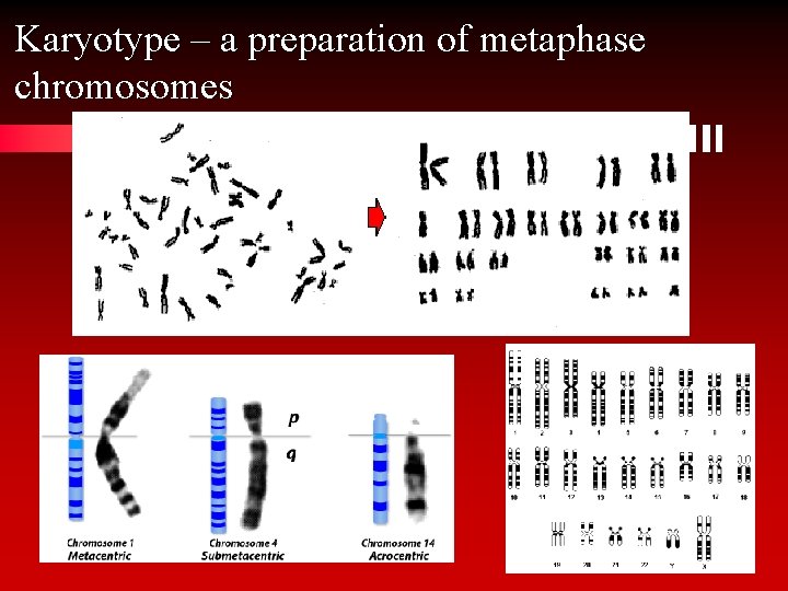 Karyotype – a preparation of metaphase chromosomes 