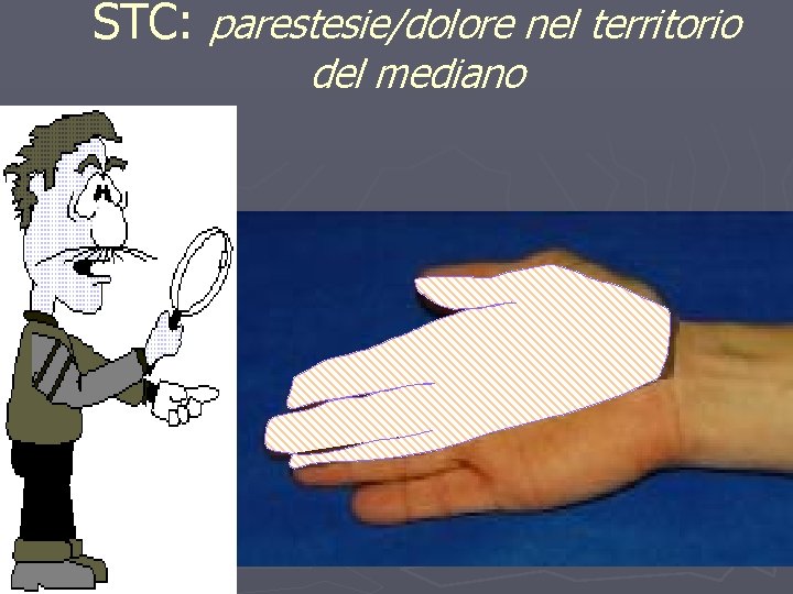 STC: parestesie/dolore nel territorio del mediano 