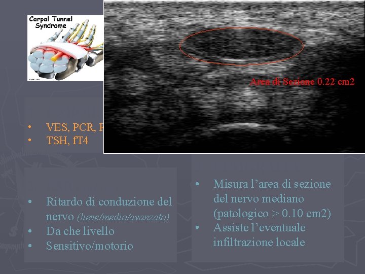 SINDROME DEL TUNNEL CARPALE: Area di Sezione 0. 22 cm 2 1. LABORATORIO •