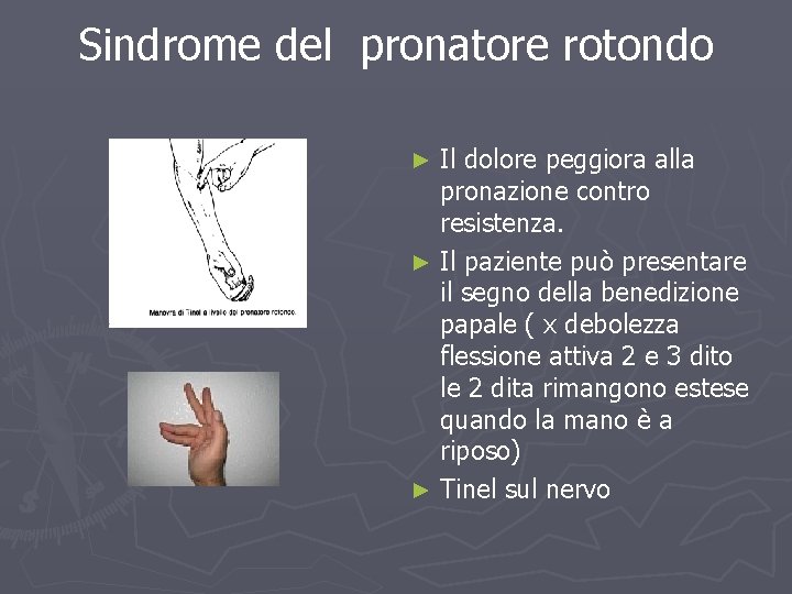 Sindrome del pronatore rotondo Il dolore peggiora alla pronazione contro resistenza. ► Il paziente