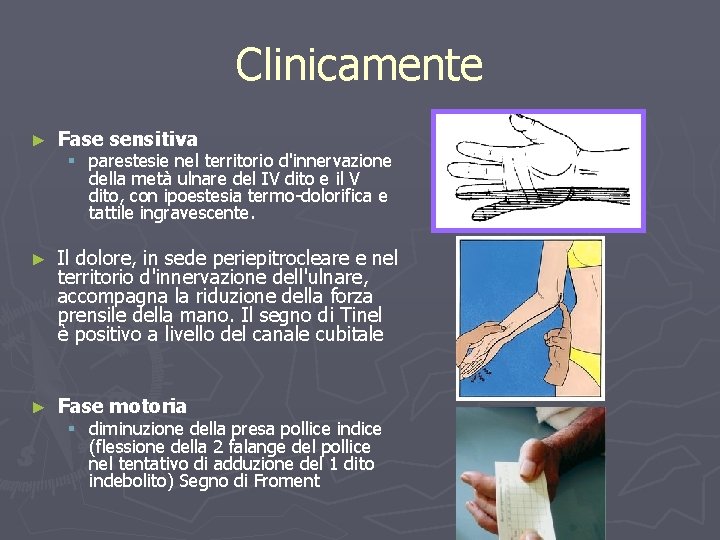 Clinicamente ► Fase sensitiva ► Il dolore, in sede periepitrocleare e nel territorio d'innervazione