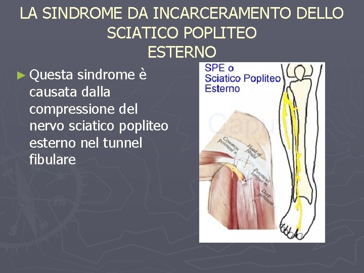 LA SINDROME DA INCARCERAMENTO DELLO SCIATICO POPLITEO ESTERNO ► Questa sindrome è causata dalla