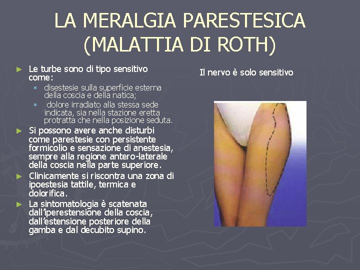 LA MERALGIA PARESTESICA (MALATTIA DI ROTH) ► Le turbe sono di tipo sensitivo come: