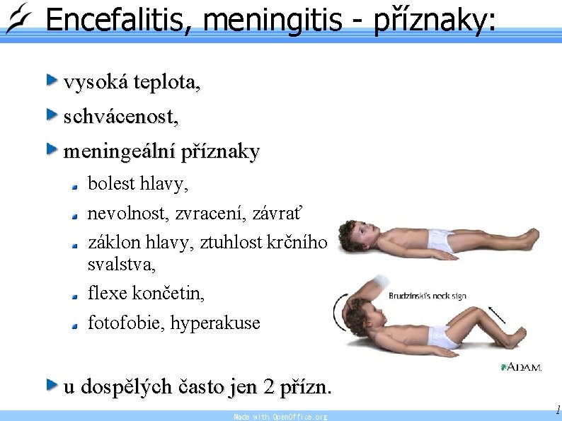 Encefalitis, meningitis - příznaky: vysoká teplota, schvácenost, meningeální příznaky bolest hlavy, nevolnost, zvracení, závrať