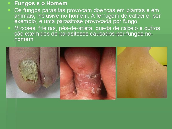 § Fungos e o Homem § Os fungos parasitas provocam doenças em plantas e