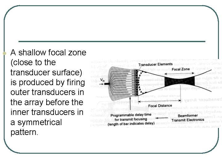 l A shallow focal zone (close to the transducer surface) is produced by firing