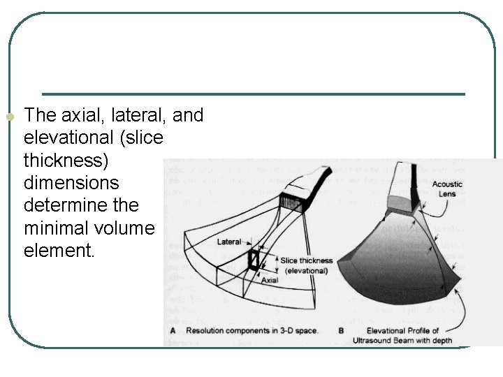 l The axial, lateral, and elevational (slice thickness) dimensions determine the minimal volume element.