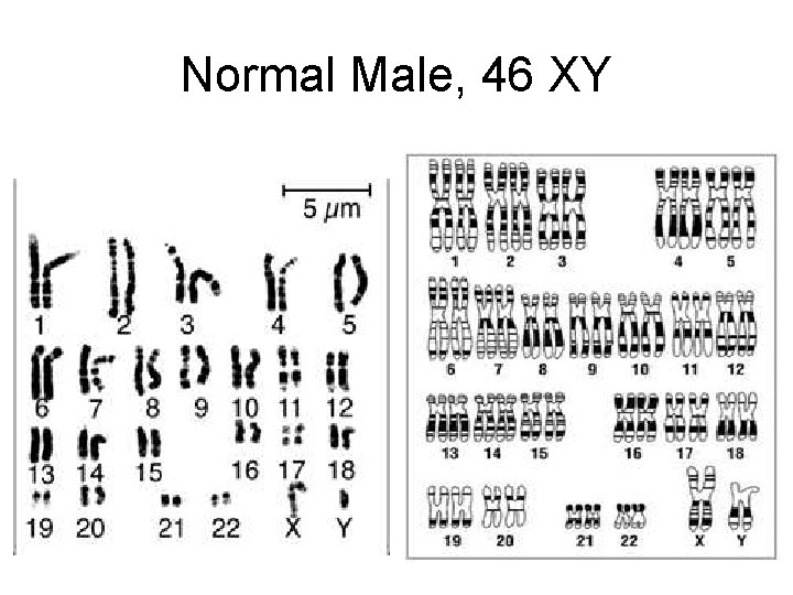 Normal Male, 46 XY 