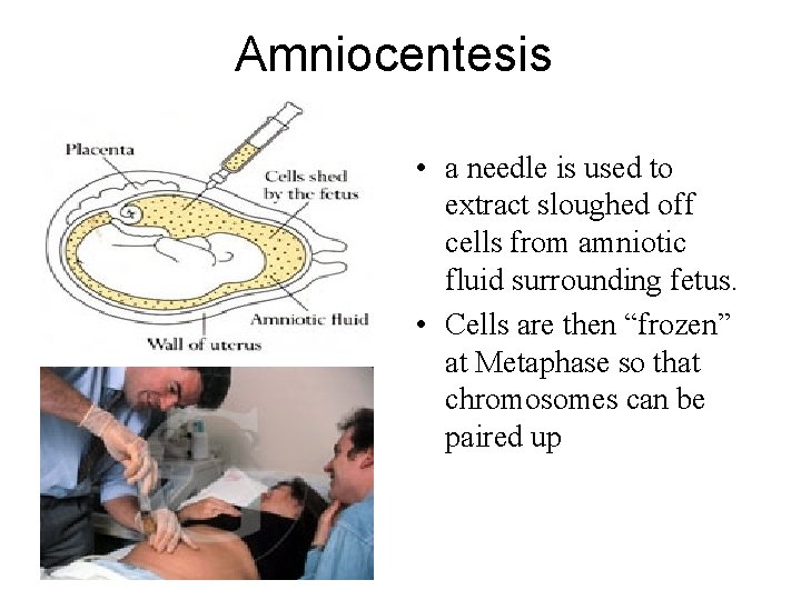 Amniocentesis • a needle is used to extract sloughed off cells from amniotic fluid