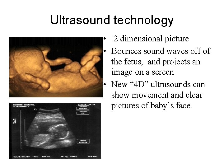 Ultrasound technology • 2 dimensional picture • Bounces sound waves off of the fetus,