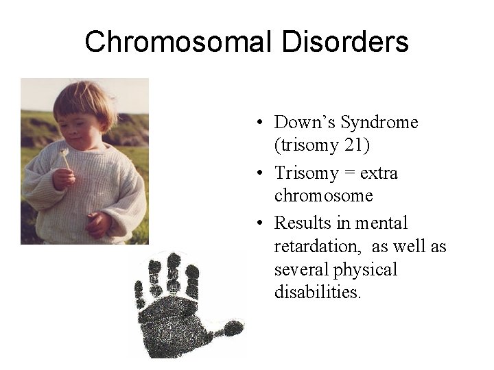 Chromosomal Disorders • Down’s Syndrome (trisomy 21) • Trisomy = extra chromosome • Results