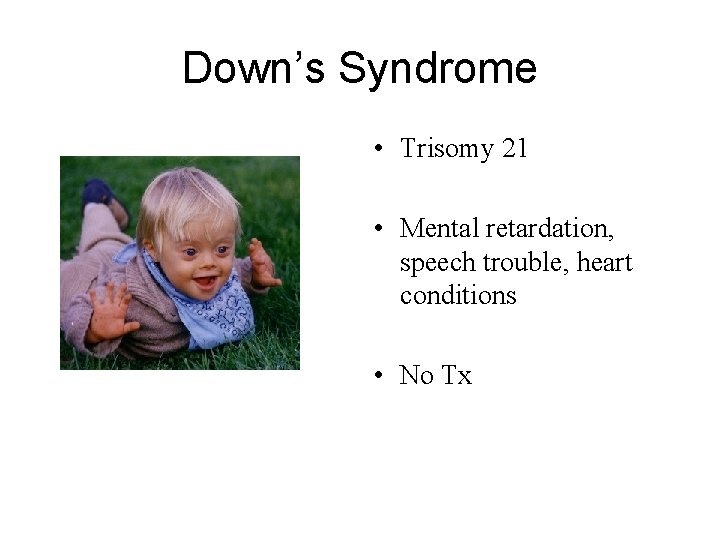 Down’s Syndrome • Trisomy 21 • Mental retardation, speech trouble, heart conditions • No