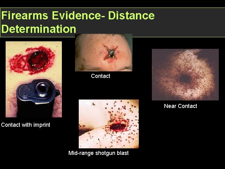 Firearms Evidence- Distance Determination Contact Near Contact with imprint Mid-range shotgun blast 