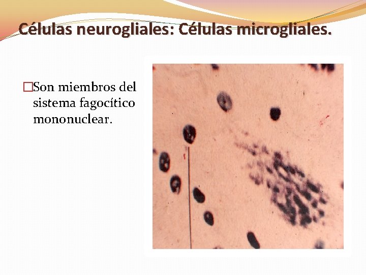 Células neurogliales: Células microgliales. �Son miembros del sistema fagocítico mononuclear. 