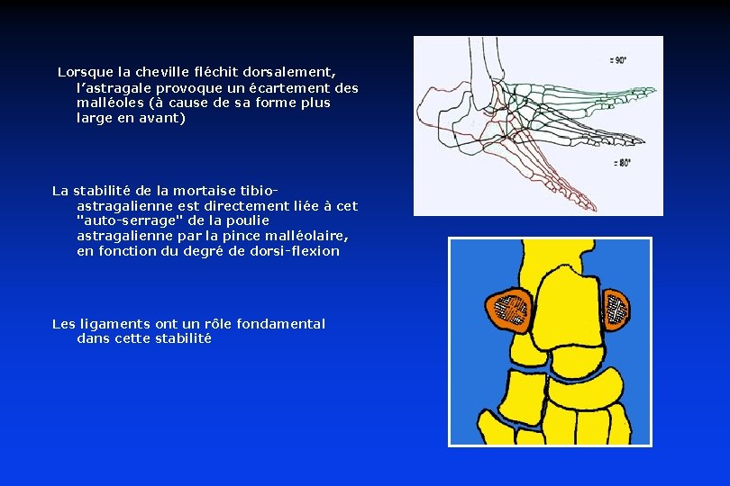 Lorsque la cheville fléchit dorsalement, l’astragale provoque un écartement des malléoles (à cause de Lorsque la cheville fléchit dorsalement, l’astragale provoque un écartement des malléoles (à cause de