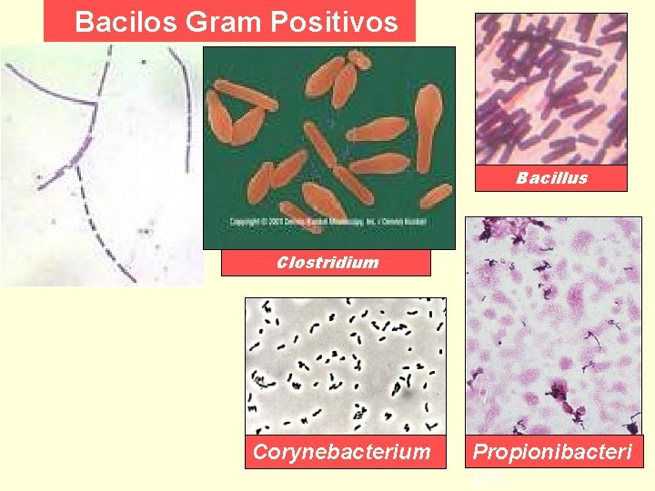 Bacilos Gram Positivos Bacillus Clostridium Corynebacterium Propionibacteri um 