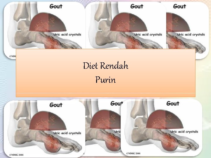 Diet Rendah Purin 