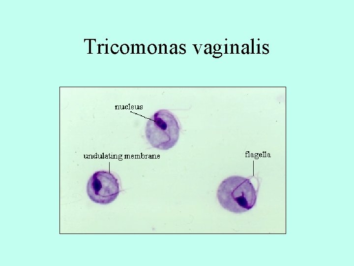 Tricomonas vaginalis 