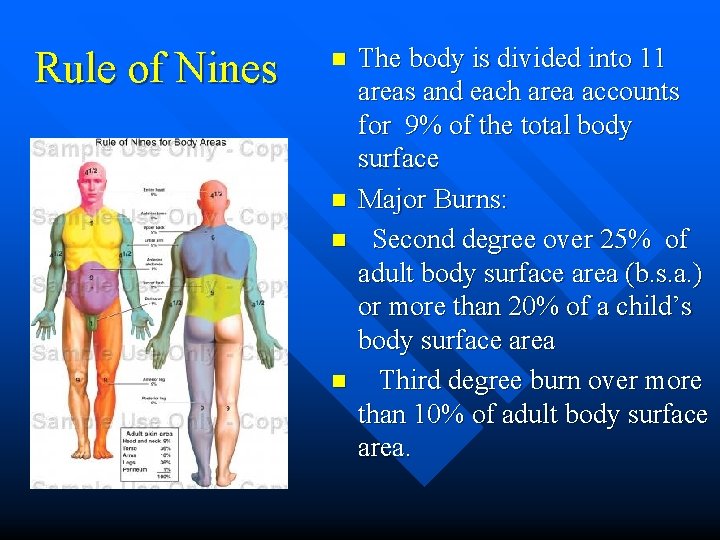 Rule of Nines n n The body is divided into 11 areas and each Rule of Nines n n The body is divided into 11 areas and each