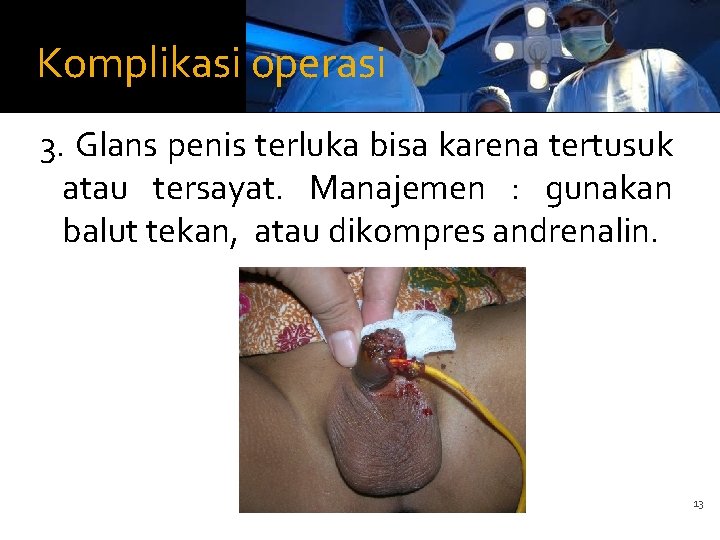 Komplikasi operasi 3. Glans penis terluka bisa karena tertusuk atau tersayat. Manajemen : gunakan