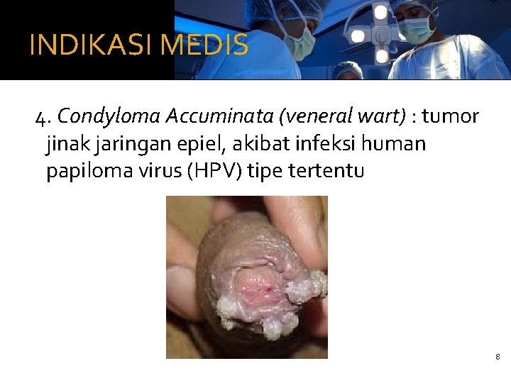 INDIKASI MEDIS 4. Condyloma Accuminata (veneral wart) : tumor jinak jaringan epiel, akibat infeksi