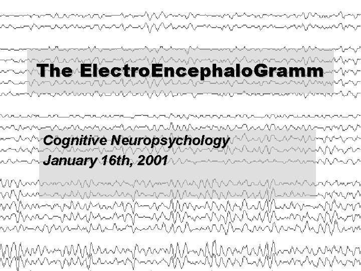 The Electro. Encephalo. Gramm Cognitive Neuropsychology January 16 th, 2001 