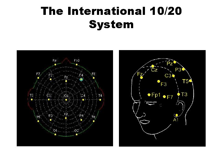 The International 10/20 System 