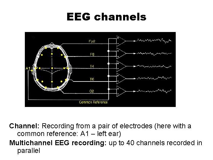 EEG channels Channel: Recording from a pair of electrodes (here with a common reference: