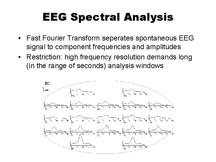 EEG Spectral Analysis • Fast Fourier Transform seperates spontaneous EEG signal to component frequencies