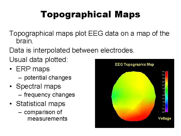 Topographical Maps Topographical maps plot EEG data on a map of the brain. Data