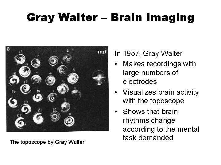 Gray Walter – Brain Imaging The toposcope by Gray Walter In 1957, Gray Walter