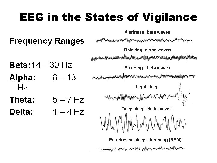 EEG in the States of Vigilance Frequency Ranges Beta: 14 – 30 Hz Alpha: