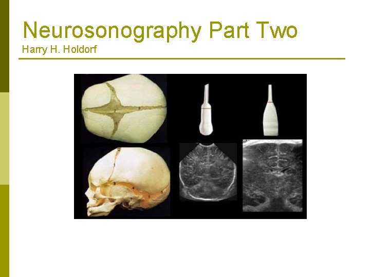 Neurosonography Part Two Harry H. Holdorf 