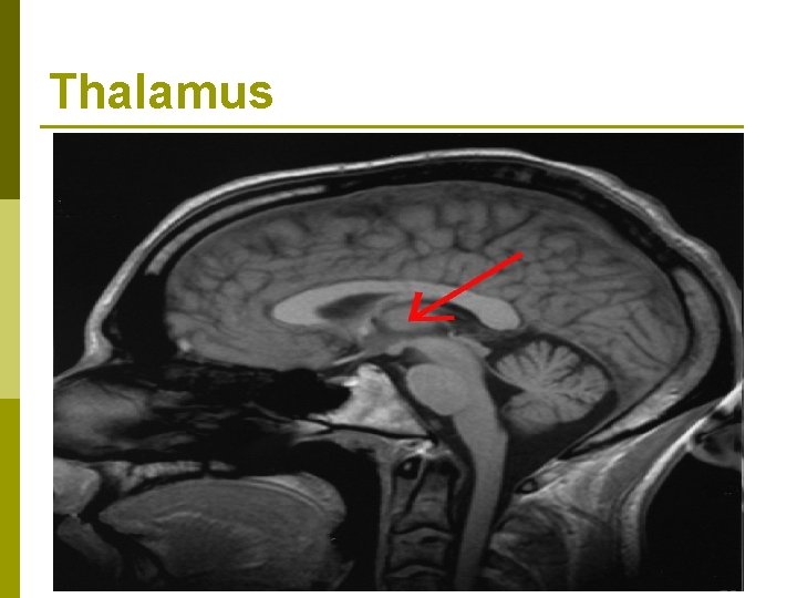 Thalamus Thalamus