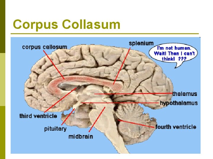 Corpus Collasum Corpus Collasum