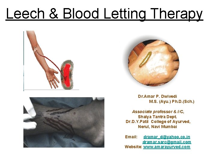 Leech & Blood Letting Therapy Dr. Amar P. Dwivedi M. S. (Ayu. ) Ph.