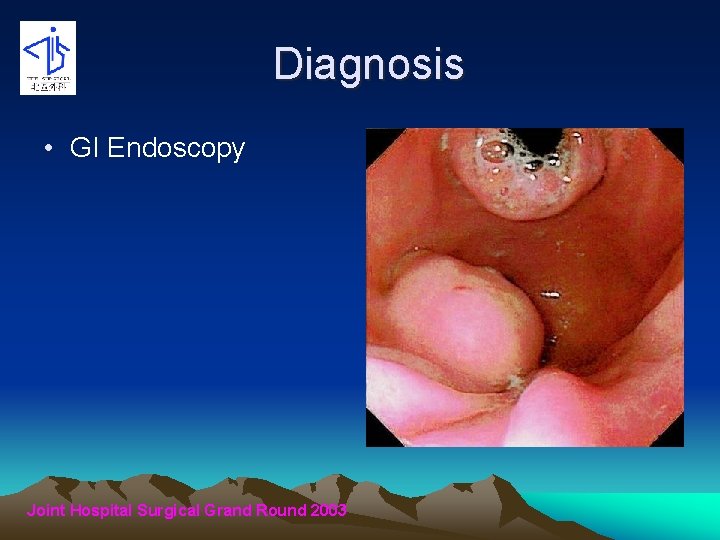 Diagnosis • GI Endoscopy Joint Hospital Surgical Grand Round 2003 