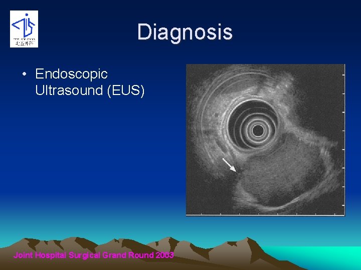 Diagnosis • Endoscopic Ultrasound (EUS) Joint Hospital Surgical Grand Round 2003 