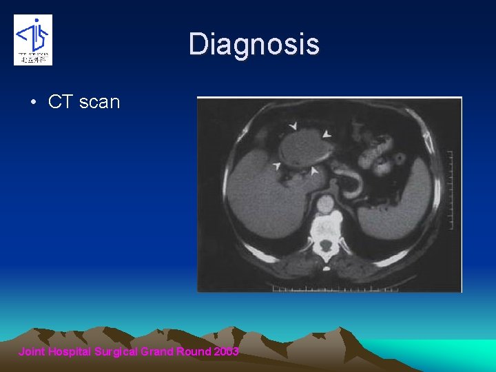 Diagnosis • CT scan Joint Hospital Surgical Grand Round 2003 