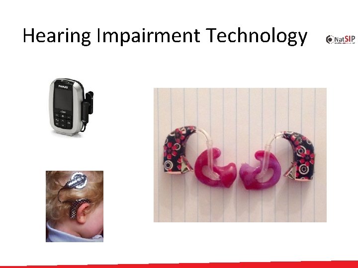 Hearing Impairment Technology 