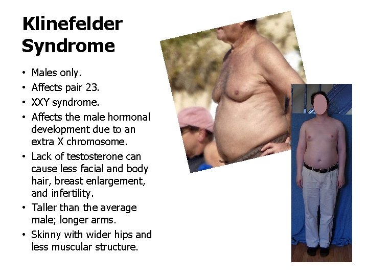 Klinefelder Syndrome Males only. Affects pair 23. XXY syndrome. Affects the male hormonal development