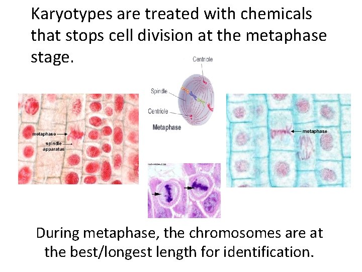 Karyotypes are treated with chemicals that stops cell division at the metaphase stage. During