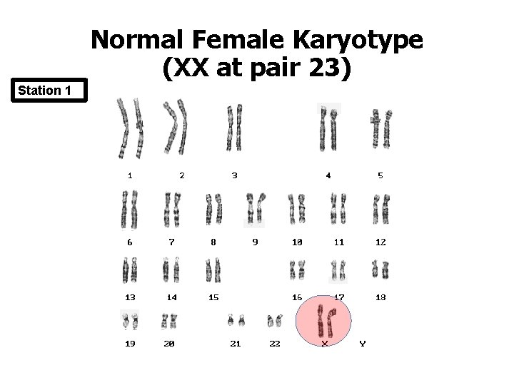 Normal Female Karyotype (XX at pair 23) Station 1 