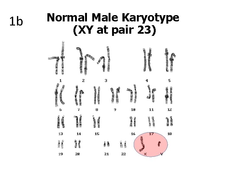 1 b Normal Male Karyotype (XY at pair 23) 