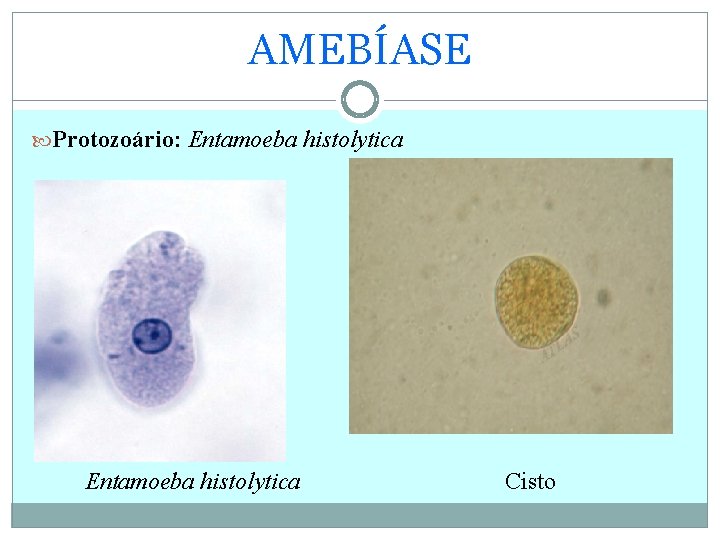 AMEBÍASE Protozoário: Entamoeba histolytica Cisto 