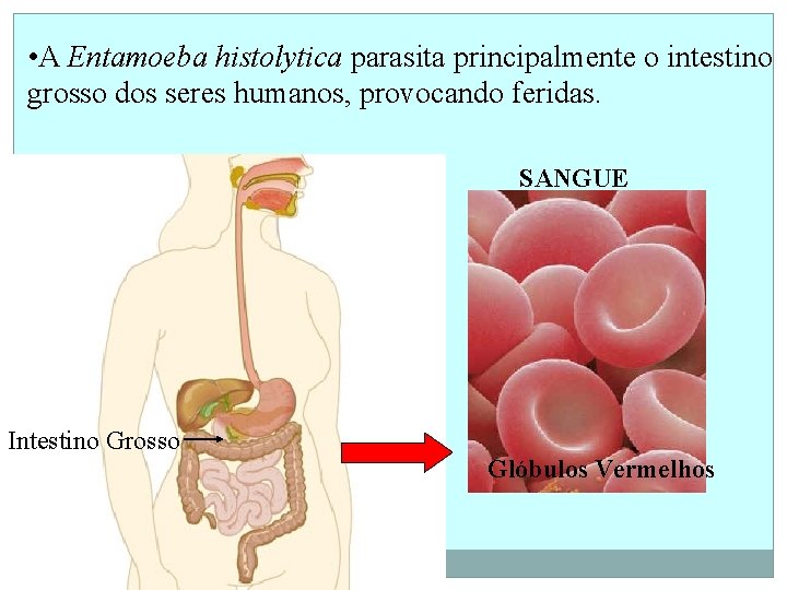  • A Entamoeba histolytica parasita principalmente o intestino grosso dos seres humanos, provocando