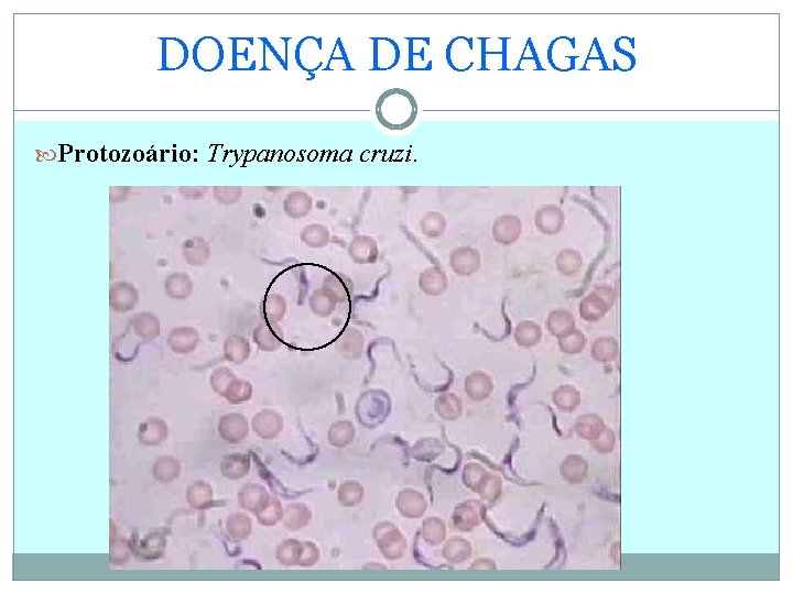 DOENÇA DE CHAGAS Protozoário: Trypanosoma cruzi. 