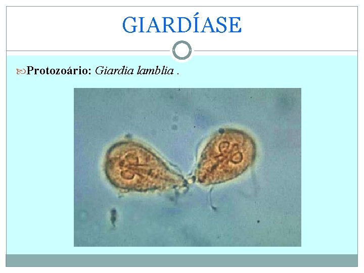 GIARDÍASE Protozoário: Giardia lamblia. 